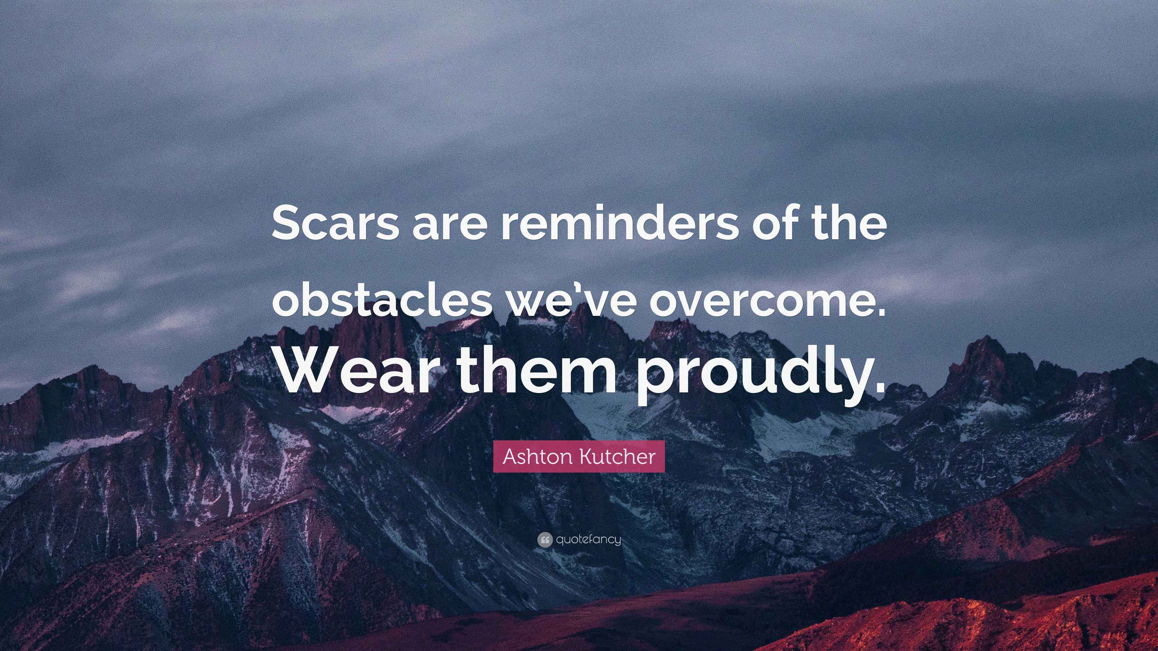 Ashton Kutcher Quote “Scars are reminders of the obstacles we’ve