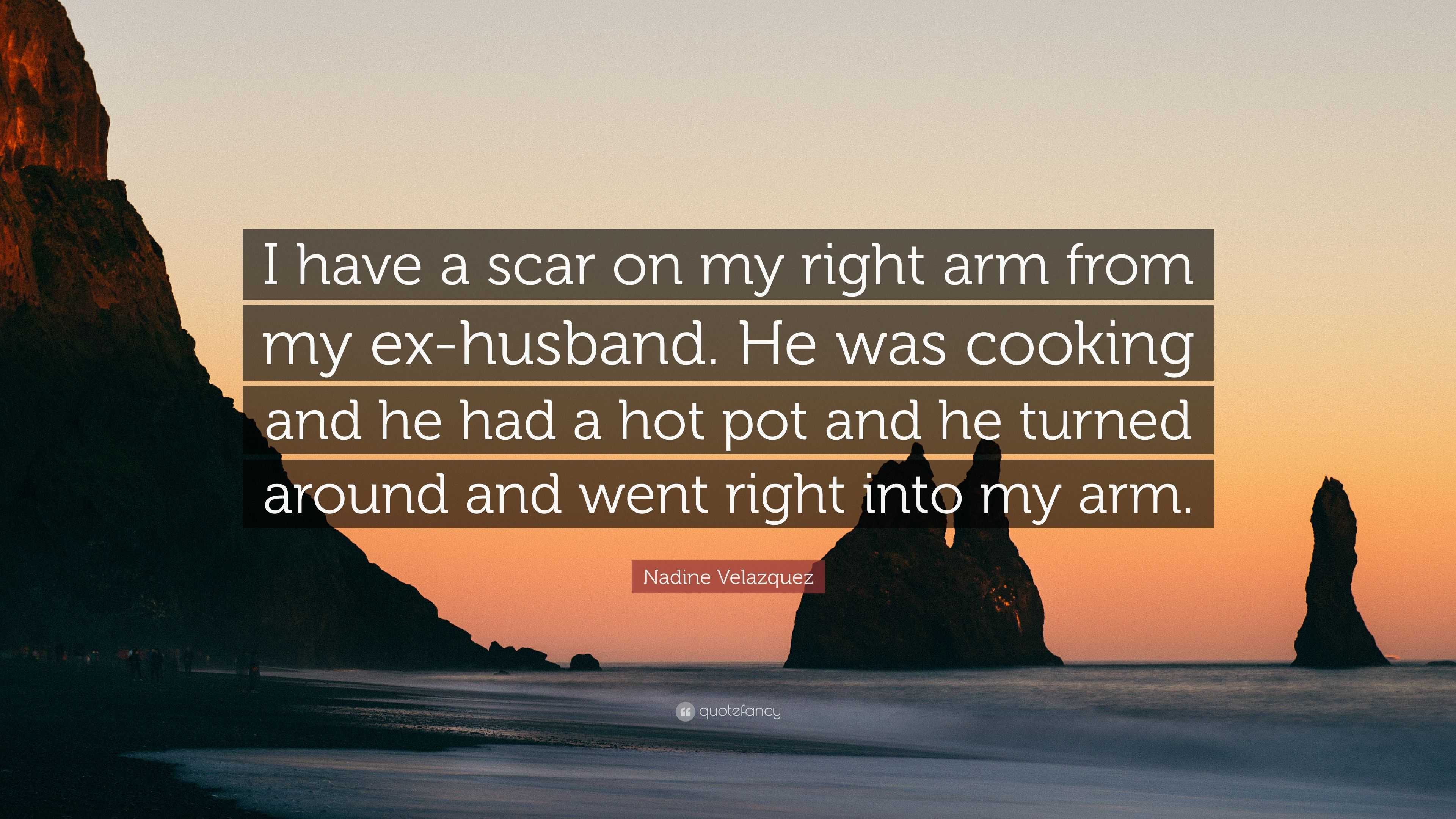 Nadine Velazquez Quote: “I have a scar on my right arm from my ex-husband.  He was cooking and he had a hot pot and he turned around and went righ...”