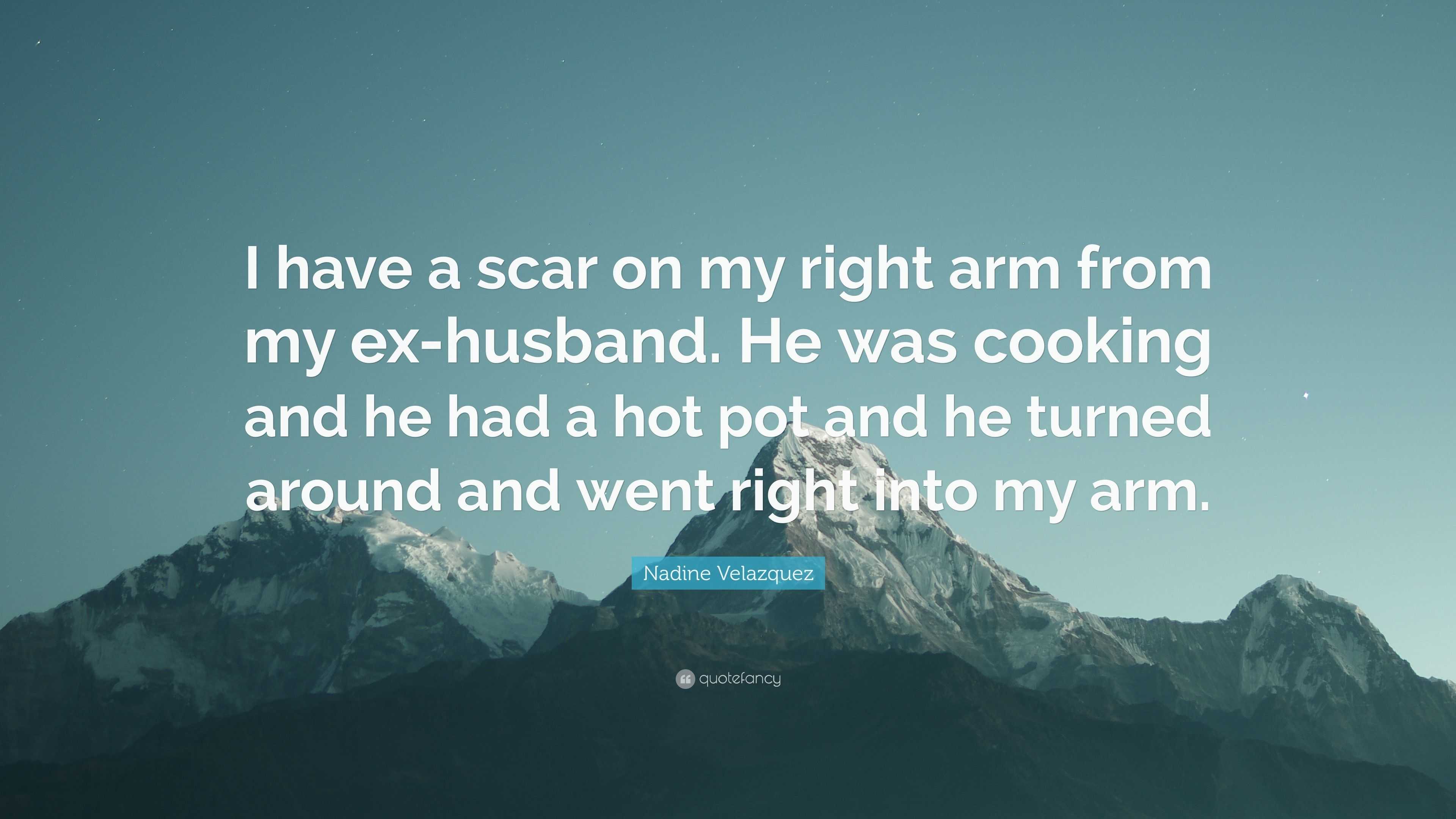 Nadine Velazquez Quote: “I have a scar on my right arm from my ex-husband.  He was cooking and he had a hot pot and he turned around and went righ...”