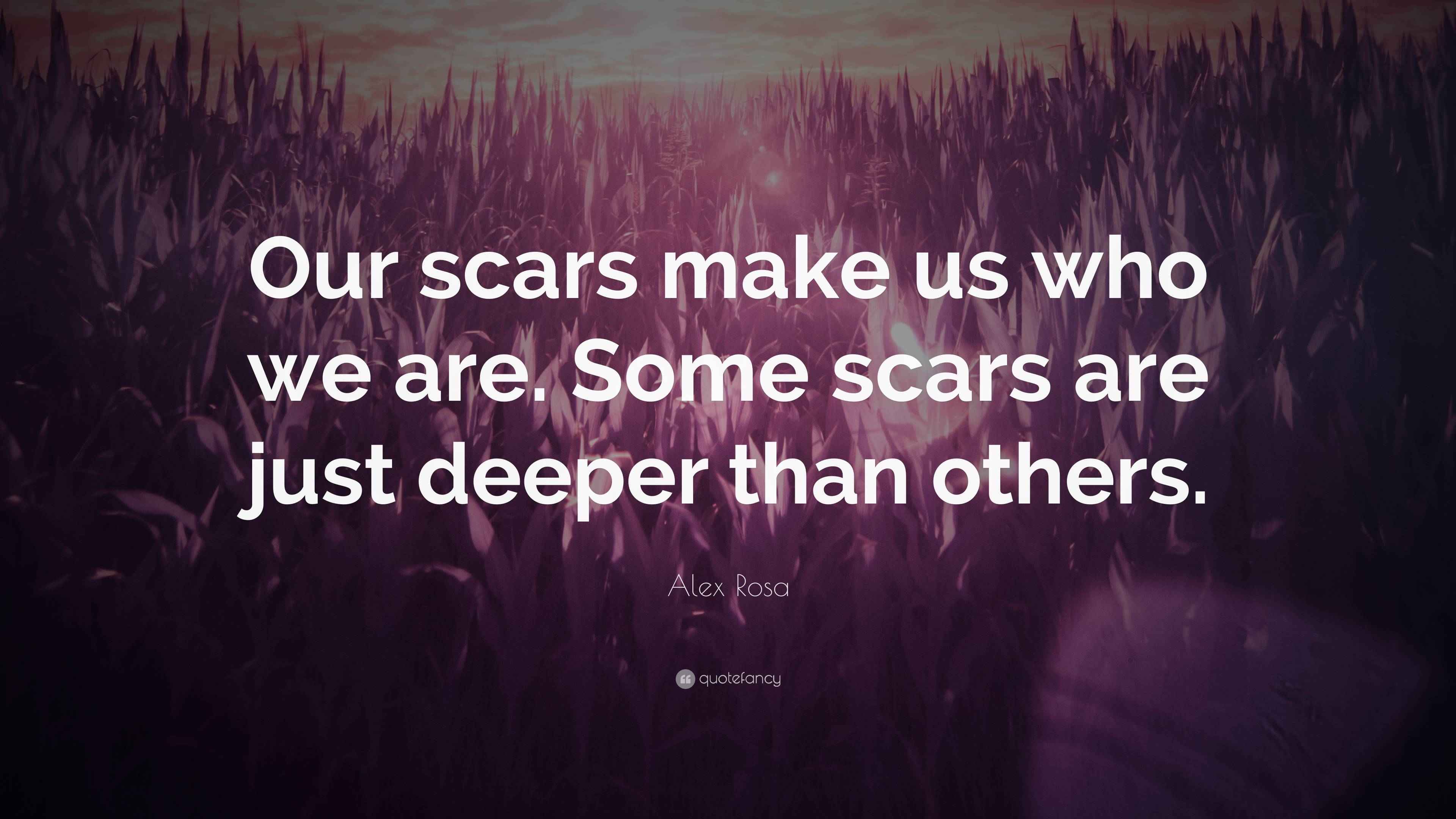 Alex Rosa Quote “Our scars make us who we are. Some scars are just