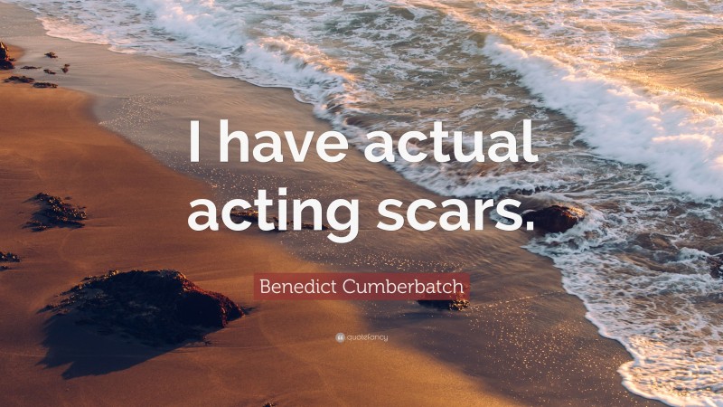Benedict Cumberbatch Quote: “I have actual acting scars.”