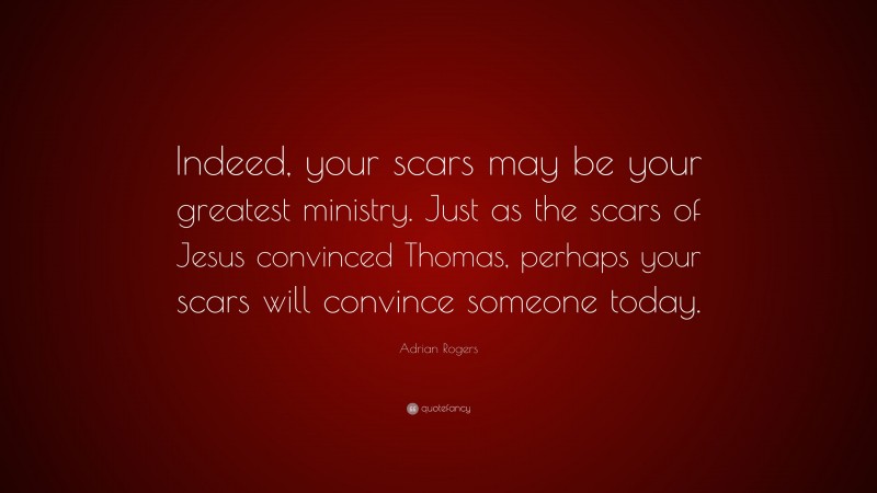 Adrian Rogers Quote: “Indeed, your scars may be your greatest ministry. Just as the scars of Jesus convinced Thomas, perhaps your scars will convince someone today.”