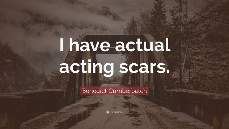 Benedict Cumberbatch Quote: “I have actual acting scars.”