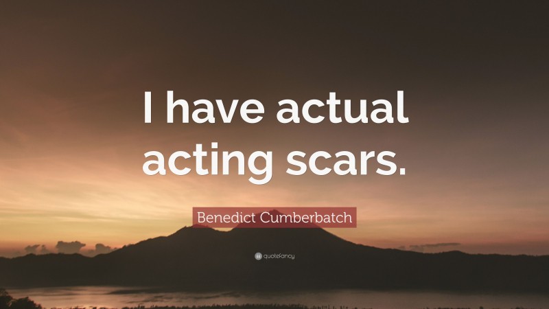 Benedict Cumberbatch Quote: “I have actual acting scars.”
