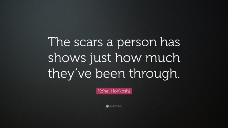 Kohei Horikoshi Quote: “The scars a person has shows just how much they’ve been through.”