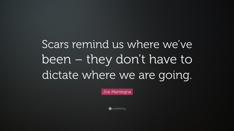 Joe Mantegna Quote: “Scars remind us where we’ve been – they don’t have to dictate where we are going.”